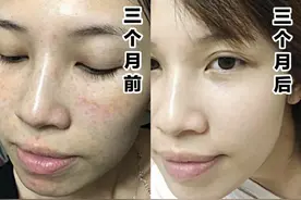 6款网红热门祛斑精华大测评！图片