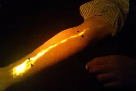 中医经络存在添新证据！科研人员首次清晰观察到沿人体经络穴位迁移的连续荧光线图片