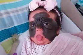 女婴因胎记遭网暴：这种怪物就该杀掉！她的父母好勇敢…图片