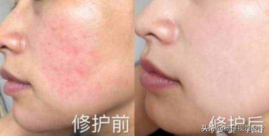 海藻面膜怎么敷 2026年海藻面膜怎么敷效果最好,敷多久合适以及适合什