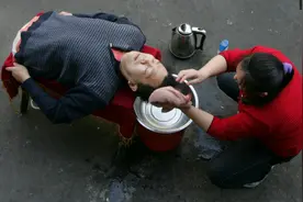 世界上截肢位最高的“半截人”，只剩七十八厘米的他依然乐观生活图片