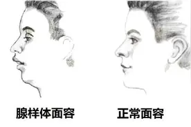打鼾不是病？这7大危害你都知道吗？图片