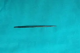 好奇心让人眩晕！男孩将7CM钢针塞进尿道，还造成穿孔图片