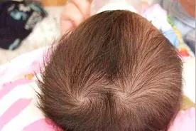 孩子头顶“两个旋”，究竟代表什么？父母都应该知道下图片