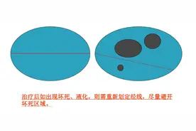 医生怎么判断治疗效果好不好？一文读懂“疗效评估”图片
