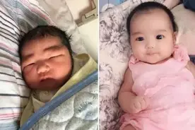 “最美女婴”VS“皱巴男婴”：新生儿的颜值差距为啥会这么大图片