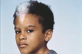 人体那些罕见的遗传变异，看完简直感慨基因太神奇图片