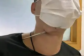 用弹弓射鱼，有人玩大了！广东一男子差点把脖子射穿图片