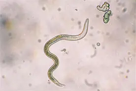 孩子出现4种表现，才说明肚子里有蛔虫，盲目喂药实没必要图片