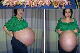 同样是怀孕，为什么有的孕妇不显怀，有的孕妇肚子却大如西瓜？图片