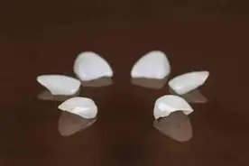 牙齿发黄怎么回事？几招好方法，能让牙齿变白图片