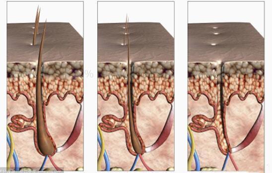 沙宣“退位让贤”，护发届翘楚“阿玛尼”上线，网友：良心洗发水