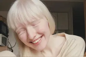 她被嘲“吸血鬼”，21岁逆袭成超模，获网友大赞：天使路过人间图片