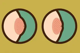 分手吧，谁让你乳头内陷！图片
