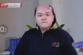 到底有多少Rapper表面光鲜亮丽，背后却偷偷秃头？图片