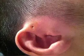 科学家说人是由鱼进化而来，那么现在人体内还保留着哪些证据呢？图片