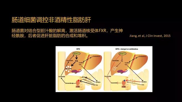 贾伟：肝病肠治？且看肠道细菌如何对肝病推波助澜