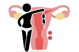 女性私处毛毛太密，能刮掉吗？医生说出实话，看完再做决定图片