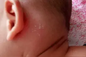 5岁宝宝耳道发炎听力减退，去医院检查后竟是妈妈洁癖惹的祸图片