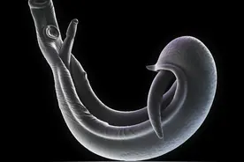 请立即停食这三种食物，或都是寄生虫的“仓库”，开水都很难杀死图片