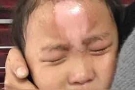 6岁孙女掉入“开水锅”，姥姥“教科书般”处理方式，让医生大赞图片