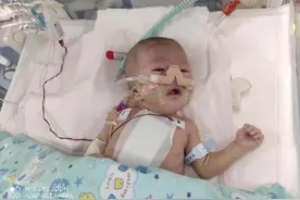 内蒙古重症患儿转运来京最新进展：全身感染重，尽全力救图片