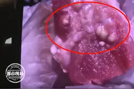 猪肉竟然长满了“疙瘩脓包”！女子切开肉之后：被吓到图片