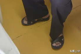 腿里有虫在爬？男子被困扰十余年，其实得了这个病图片