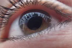 白内障是致盲性眼病！3个症状是它在预警，切忌拖延图片