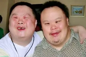 为什么唐氏综合症患者，长相都差不多？该如何预防这种疾病？图片