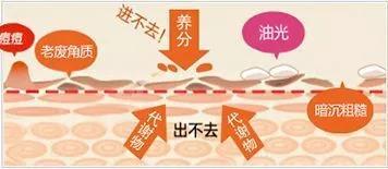 去粉刺毛囊炎痤疮鸡皮身体乳