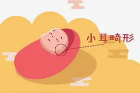 【科普系列】耳模矫正技术—帮助先天性耳廓形态畸形患儿重塑完美耳朵图片