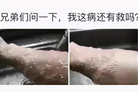 “一沾水就犯病！我这是怎么了？”不要可以卸掉，哈哈哈图片