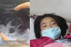 18岁女生卖卵只为买最新款手机，称卵子每个月都有不卖也是可惜图片