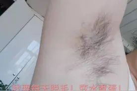 脱毛仪的频率到底应该怎么样？图片