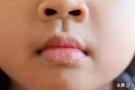 孩子嘴唇干喝水不管用？这才是正确的解决方法！图片