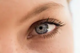 眼皮上长了脂肪粒怎么办？如何处理？3个方法教你轻松解决图片