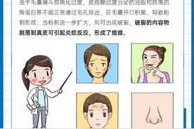 额头下巴长痘痘意味着身体不同部位出问题了吗？图片