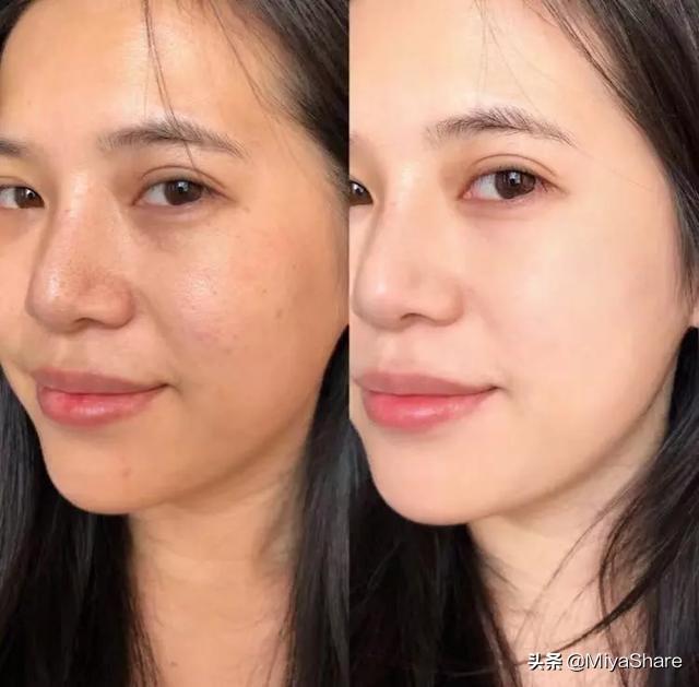 身体肤色暗沉发黄怎么调理 - 冷思维