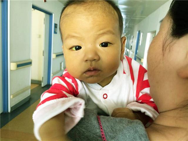 小孩乳酸脱氢酶偏高（精选问答关于宝宝巨细胞病毒感染的那些事儿）