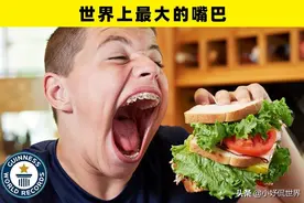 创造世界纪录，拥有不寻常身体特征的5个真实人类图片