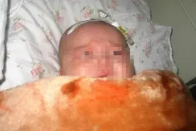 6个月女儿身上总有股怪味去不掉，宝爸起疑，医生检查后连退5步图片