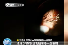 可怕又恶心！女子种完假睫毛真睫毛也保不住了：上边爬着密密麻麻的“蠕虫”图片