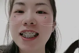 27岁在深圳做牙齿矫正花费8400元，大家觉得这个费用贵吗？