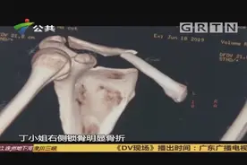 深圳：女子学舞时做“开肩” 锁骨被老师弄骨折视频封面