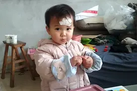 玩滑梯摔了，额头起了肿用黄酒敷贴下，还好宝宝全程配合视频封面