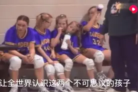 世界罕见连体婴双头姐妹一个身体还会打篮球，这身体要听哪个脑袋视频封面