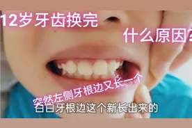 12岁的小屁孩:突然左侧牙根长一颗智慧牙？要拨掉吗？