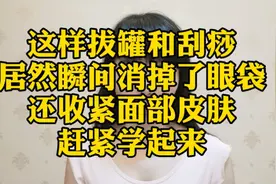 这样刮痧加拔罐，居然瞬间去掉了眼袋，还收紧了面部皮肤！学起来视频封面