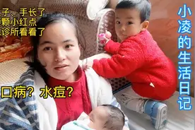 大宝肚子跟手长了一颗颗小红点，手足口病VS水痘傻傻分不清楚？视频封面